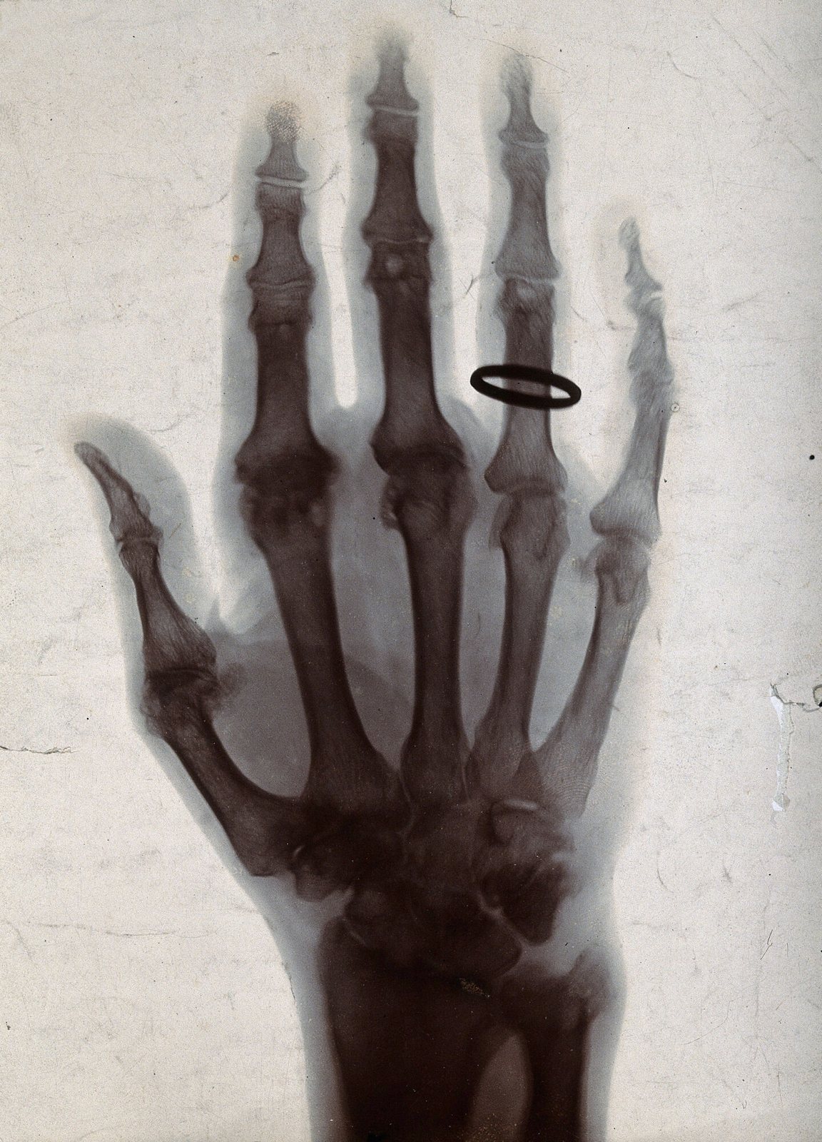 Radiografía de una mano de 1896